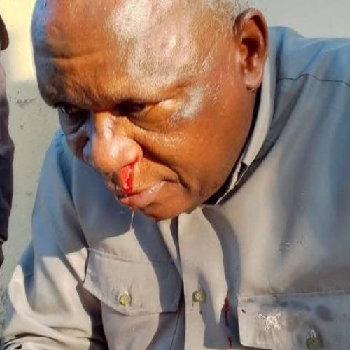Friends of Angola Condemns Attack on UNITA Members in Ngalanga: Democracy Cannot Be Built on Violence